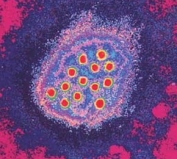 hepatitis_a.jpg