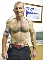 Tony Abbott